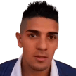 R. Alderete